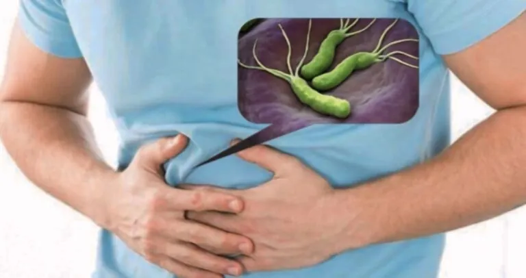 Поговорим о Хеликобактере пилори (Helicobacter Pylori), в чем опасность заболевание?